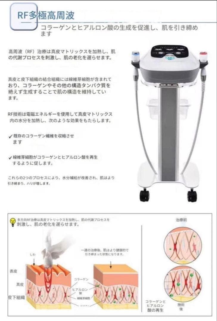 navvy！即日発送可！エレクトロポレーション RF美顔器　美容機器