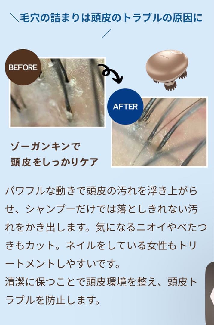 ZOGANKEN ゾーガンキン スカルプ EMS機能付き