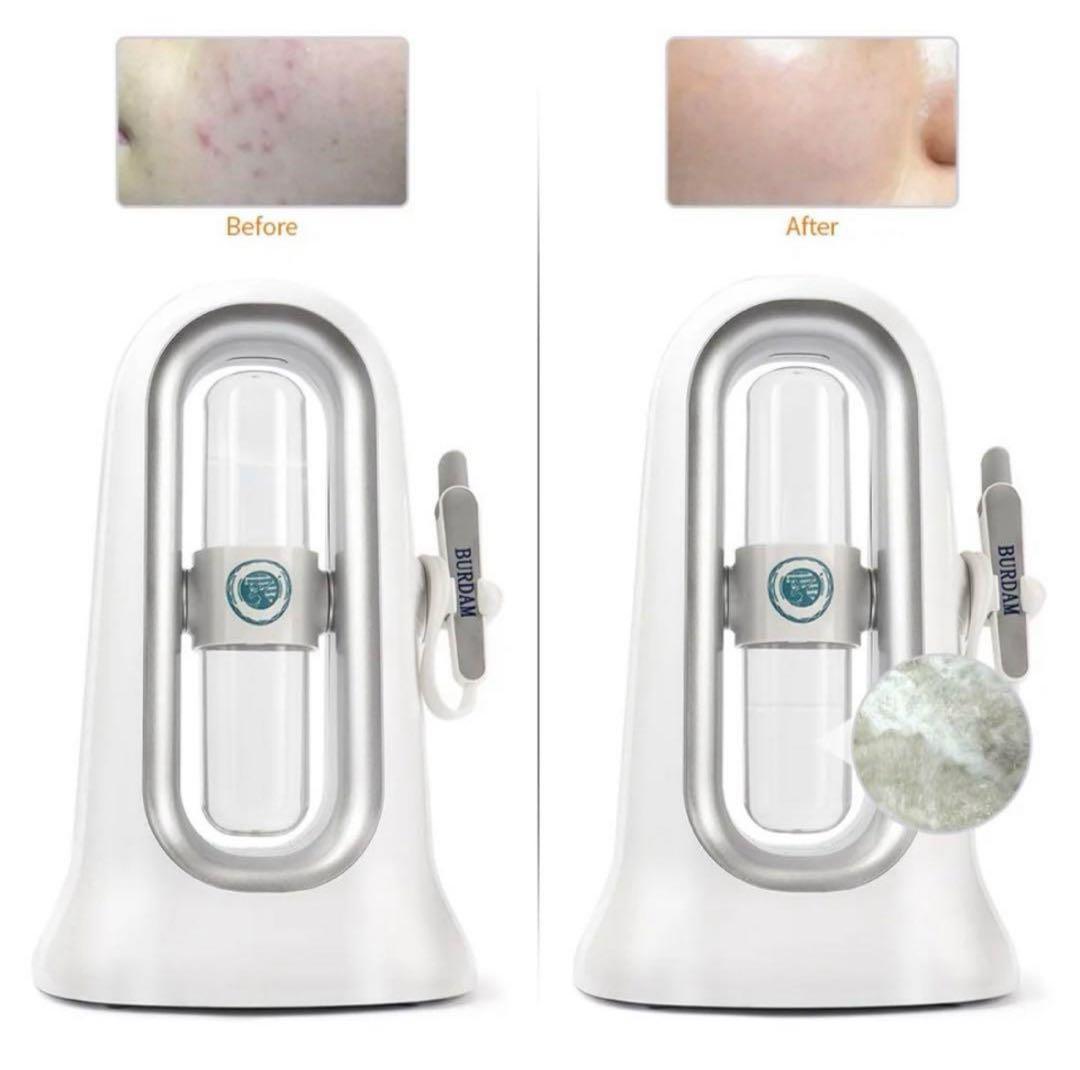 ハイドラフェイシャル 毛穴洗浄 美顔器